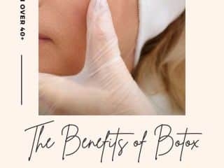 the benefits of botox