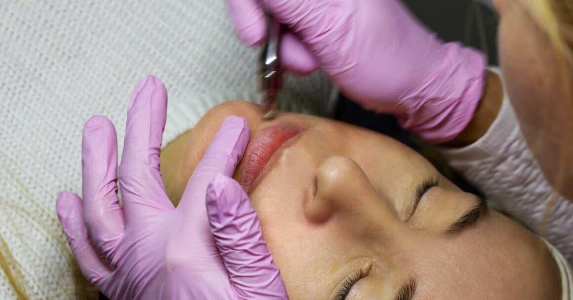 microdermabrasion for lip lines and wrinkles