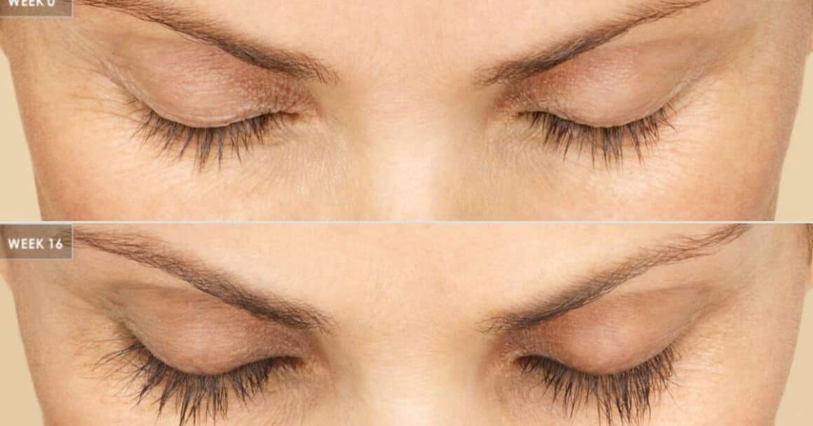 treatments for thinning eyelashes 5