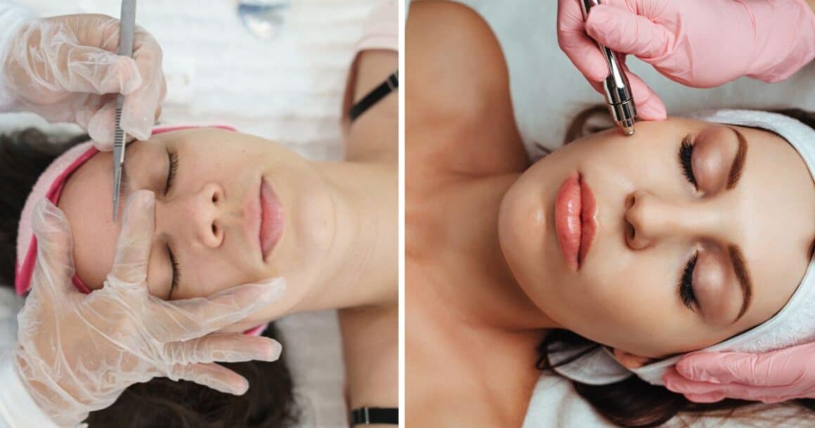 Microdermabrasion vs Dermaplaning what's the difference?